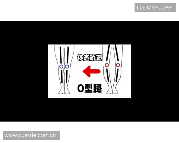 足球明星们的O型腿现象揭秘与影响分析 足球明星们的O型腿现象揭秘与影响分析